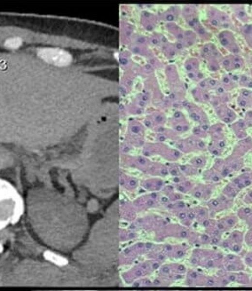 Pathology 01 Pathology 01
